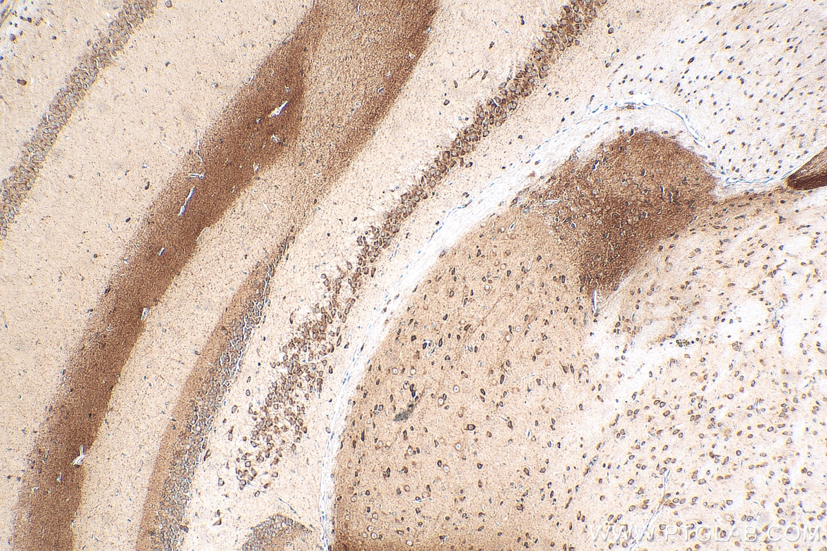 Immunohistochemistry (IHC) staining of mouse brain tissue using FBXO44 Recombinant antibody (82857-2-RR)