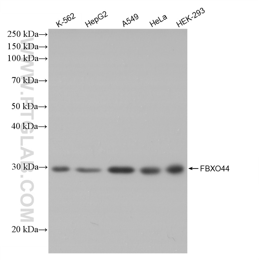 Western Blot (WB) analysis of various lysates using FBXO44 Recombinant antibody (82857-2-RR)