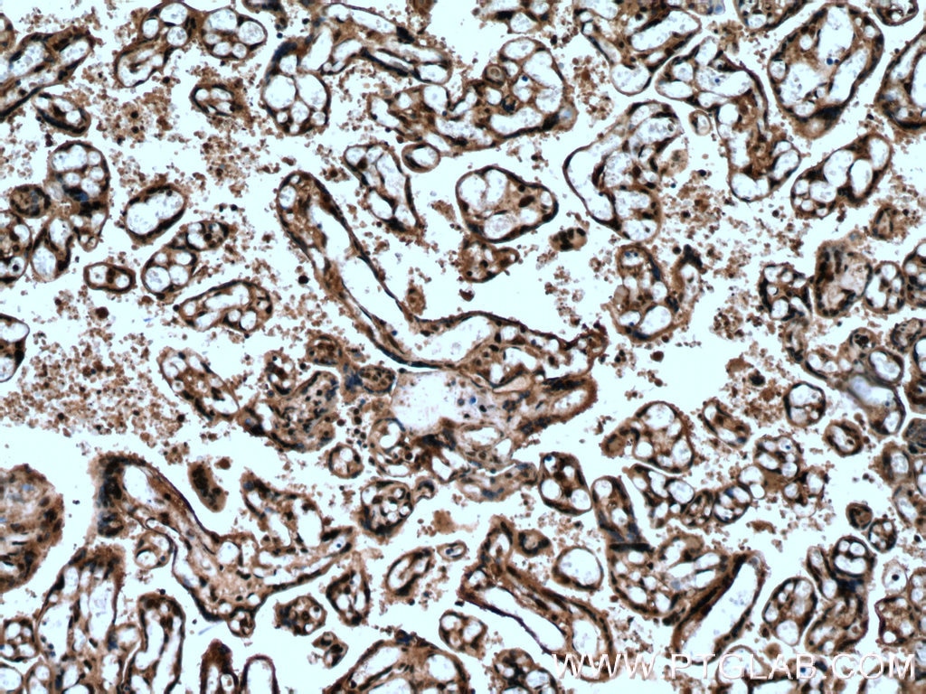 Immunohistochemistry (IHC) staining of human placenta tissue using FBXO5 Polyclonal antibody (10872-1-AP)