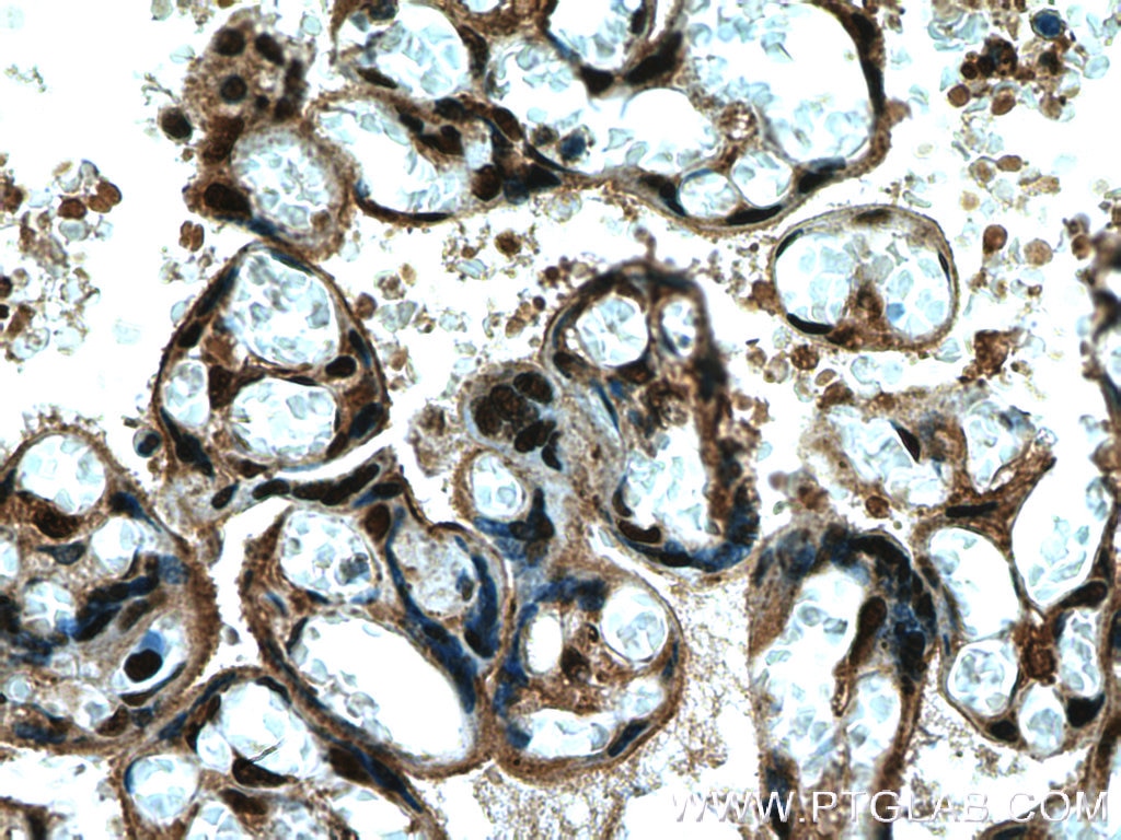 Immunohistochemistry (IHC) staining of human placenta tissue using FBXO5 Polyclonal antibody (10872-1-AP)