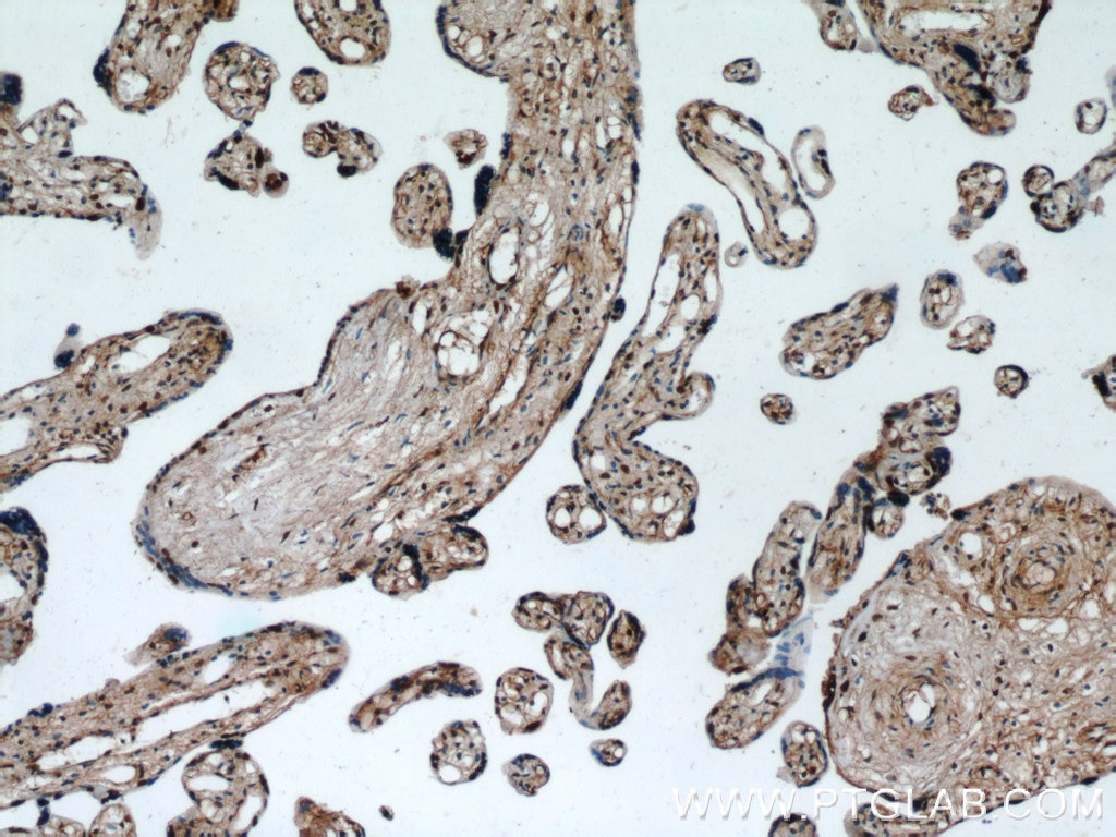 Immunohistochemistry (IHC) staining of human placenta tissue using FBXO5 Polyclonal antibody (10872-1-AP)