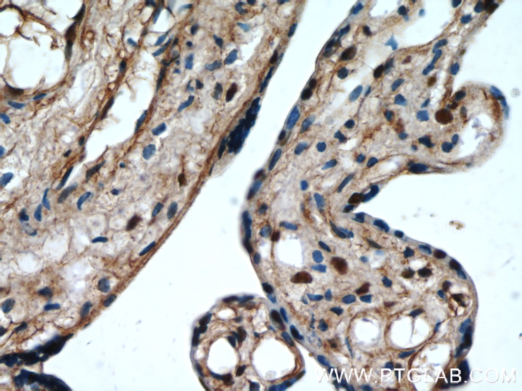 Immunohistochemistry (IHC) staining of human placenta tissue using FBXO5 Polyclonal antibody (10872-1-AP)