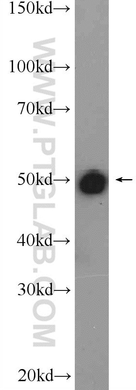 Western Blot (WB) analysis of rat liver tissue using FBXO5 Polyclonal antibody (10872-1-AP)