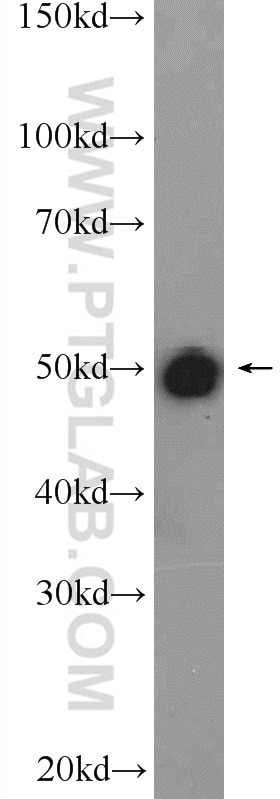 WB analysis of rat liver using 10872-1-AP