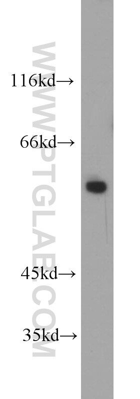 Western Blot (WB) analysis of HEK-293 cells using FBXO5 Polyclonal antibody (10872-1-AP)