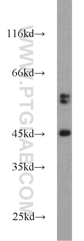 Western Blot (WB) analysis of K-562 cells using FBXO5 Polyclonal antibody (10872-1-AP)