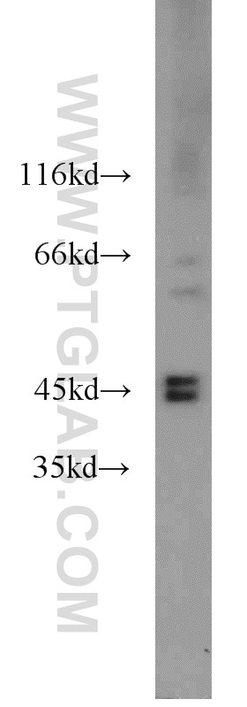 Western Blot (WB) analysis of HeLa cells using FBXO5 Polyclonal antibody (10872-1-AP)