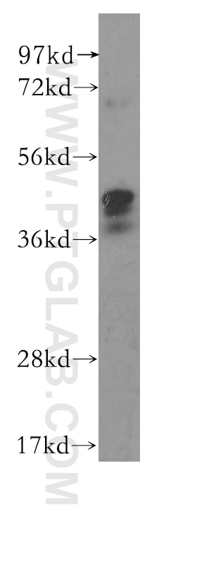 Western Blot (WB) analysis of human ovary tissue using FBXO5 Polyclonal antibody (10872-1-AP)