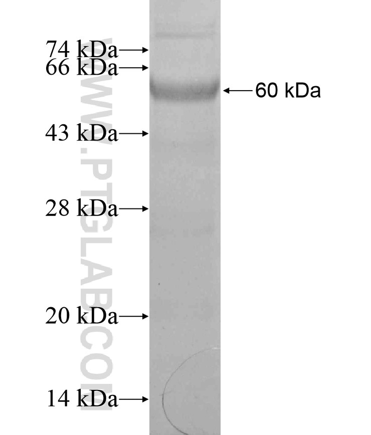 FBXO5 fusion protein Ag17870 SDS-PAGE FBXO5 fusion protein Ag17870 SDS-PAGE