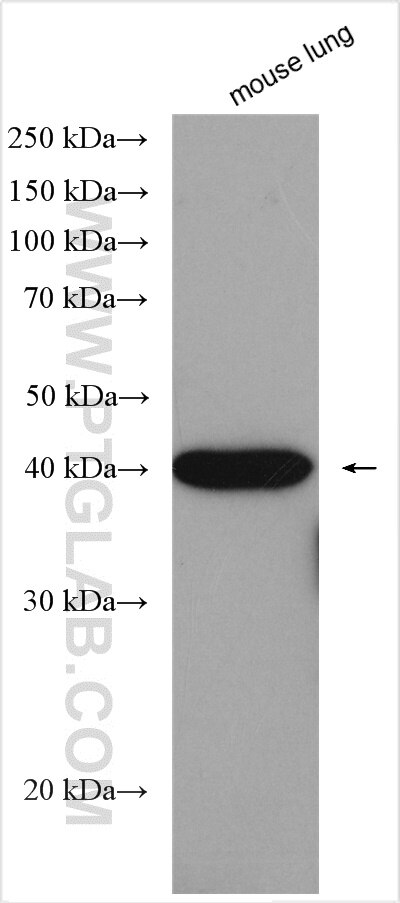 Western Blot (WB) analysis of various lysates using FBXO6 Polyclonal antibody (11830-1-AP)