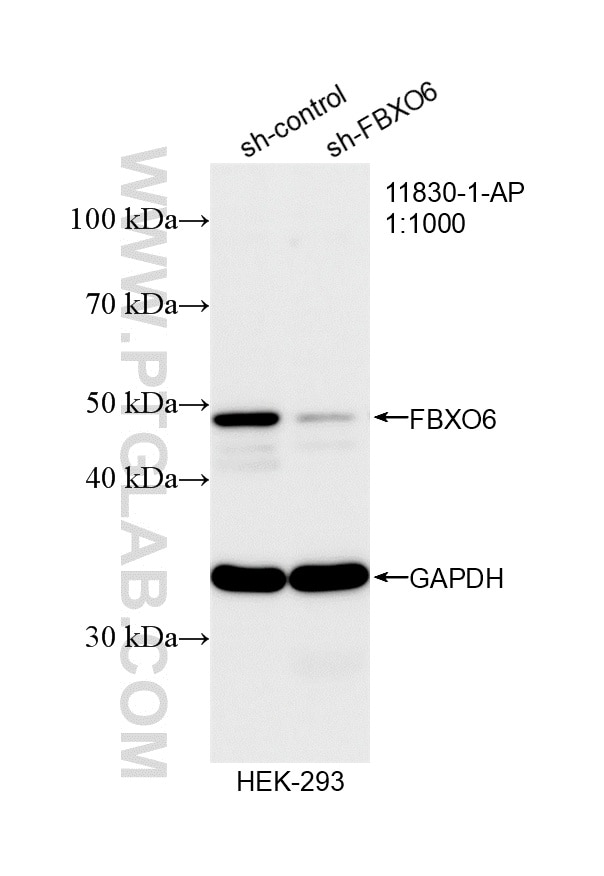 Western Blot (WB) analysis of HEK-293 cells using FBXO6 Polyclonal antibody (11830-1-AP)