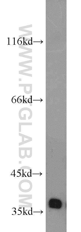 FBXO6 Polyclonal antibody