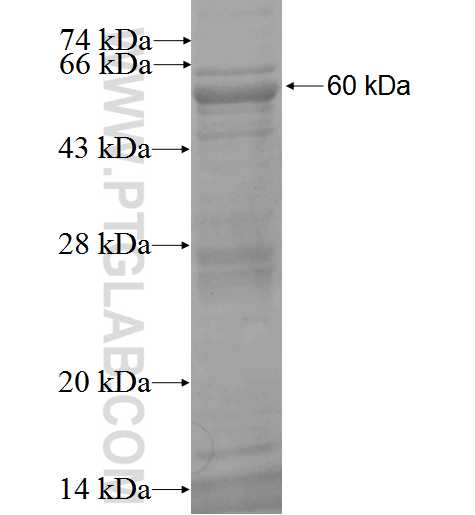 FBXO6 fusion protein Ag2400 SDS-PAGE