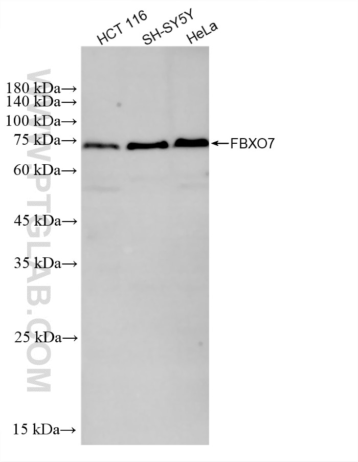 Western Blot (WB) analysis of various lysates using FBXO7 Recombinant monoclonal antibody (87451-1-RR)