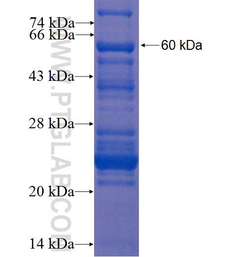 FBXO7 fusion protein Ag1035 SDS-PAGE
