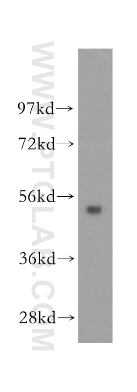 Western Blot (WB) analysis of human liver tissue using FBXO9 Polyclonal antibody (11161-1-AP)