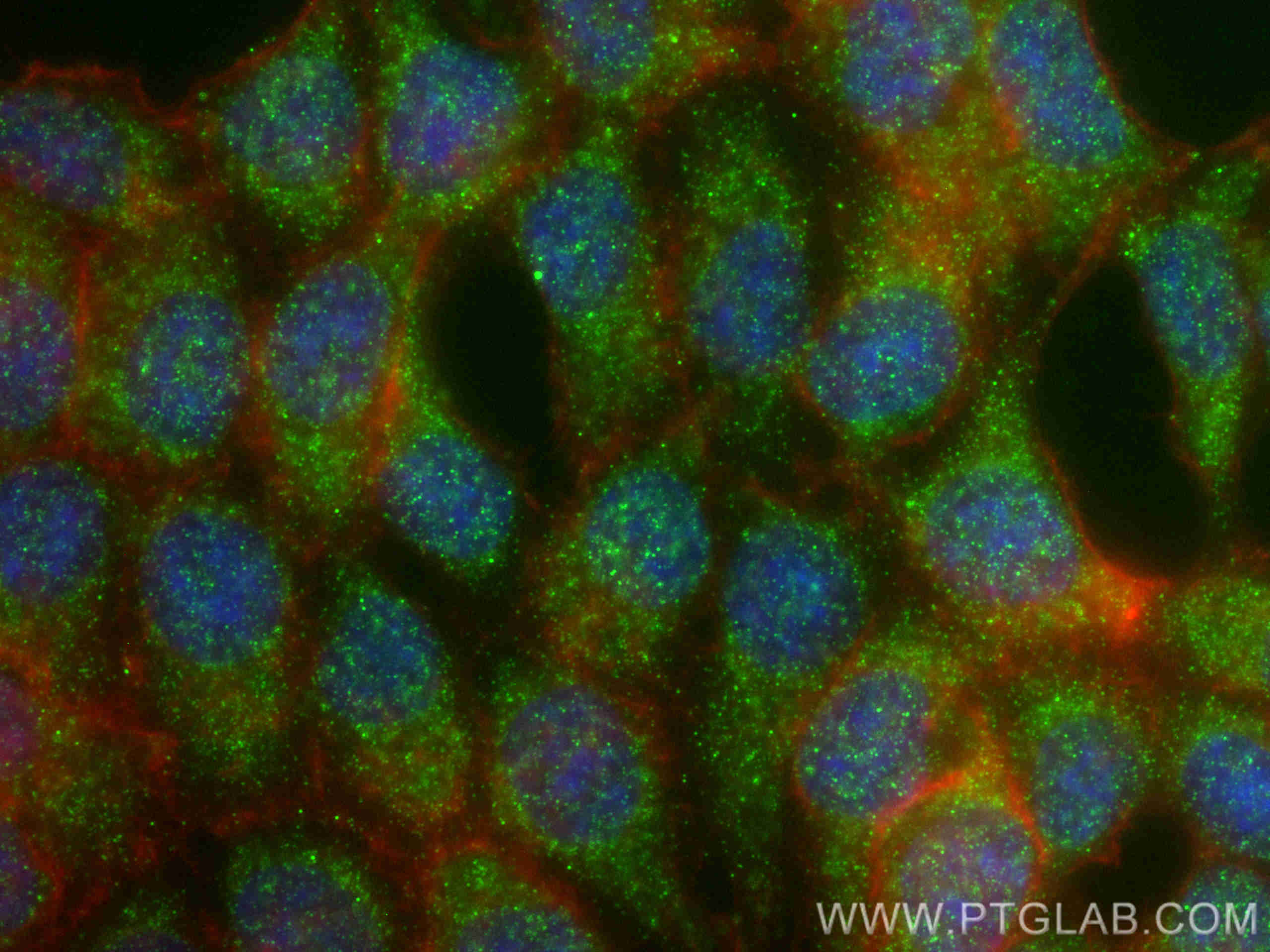 Immunofluorescence (IF) / fluorescent staining of HCT 116 cells using FBXW11 Polyclonal antibody (13149-1-AP)