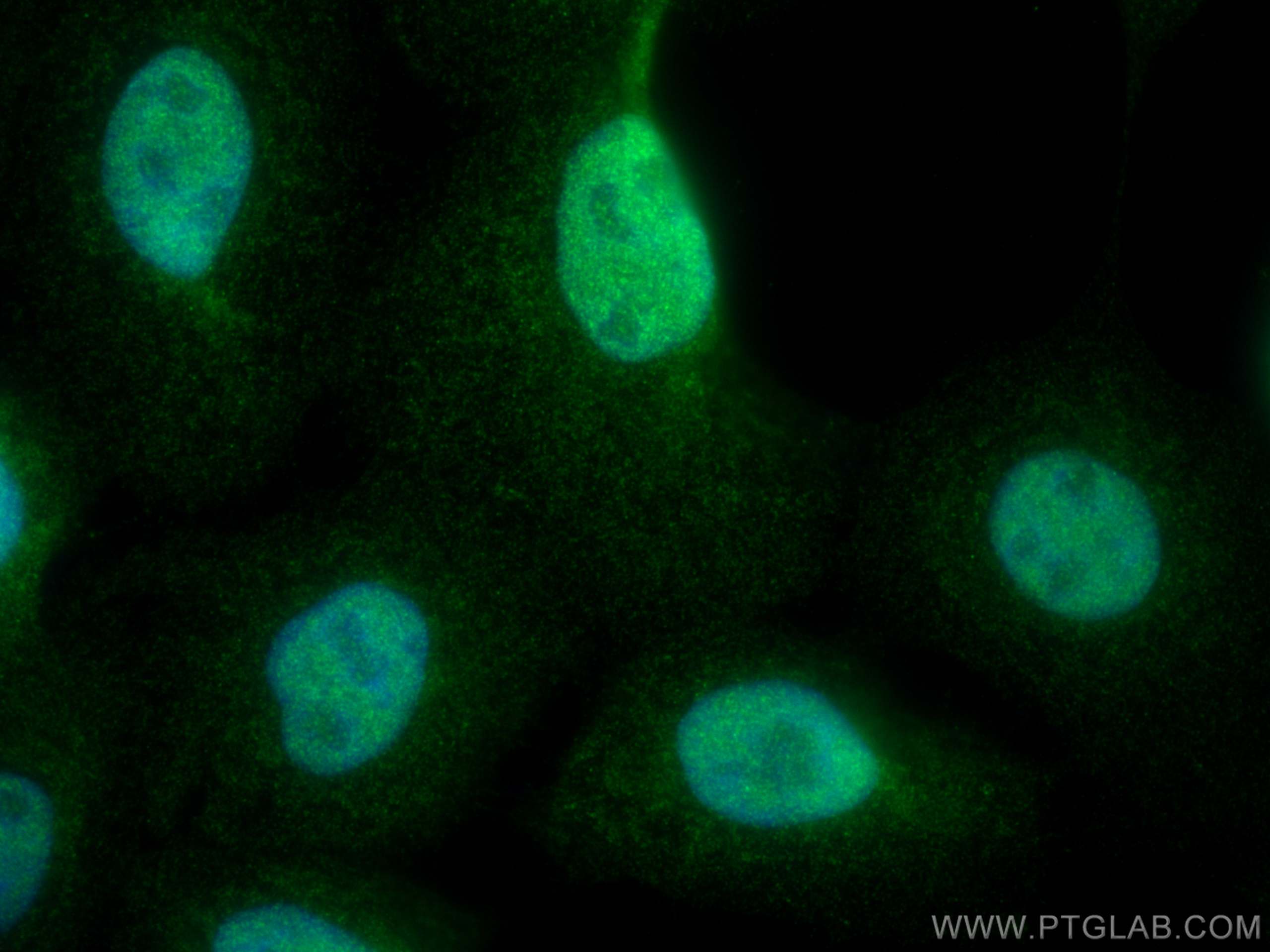 Immunofluorescence (IF) / fluorescent staining of A431 cells using FBXW11 Polyclonal antibody (13149-1-AP)