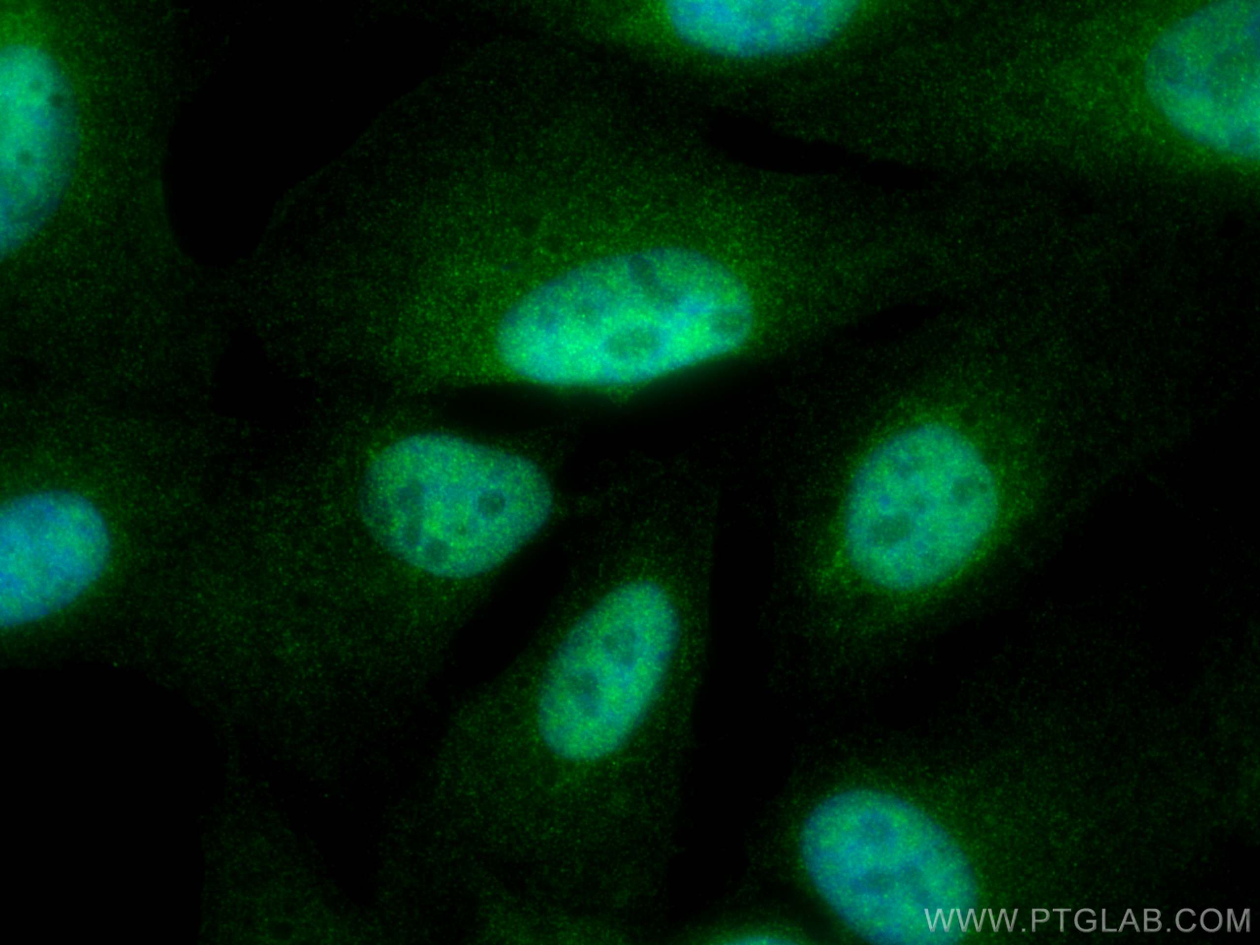 Immunofluorescence (IF) / fluorescent staining of U2OS cells using FBXW11 Polyclonal antibody (13149-1-AP)