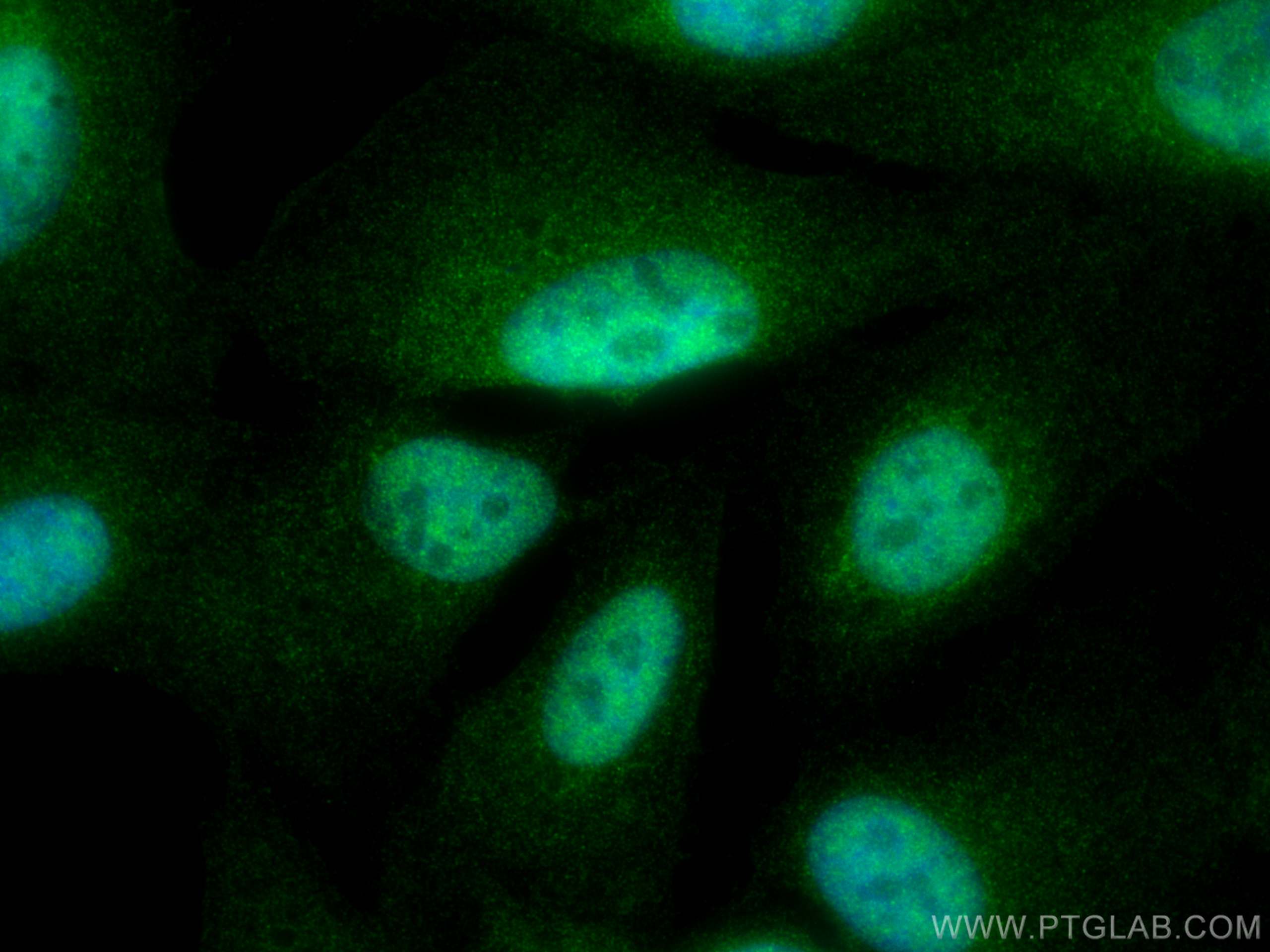 IF Staining of U2OS using 13149-1-AP