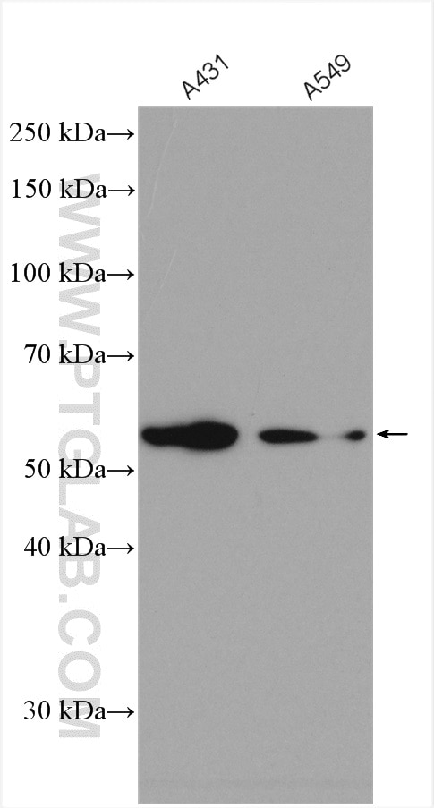 Western Blot (WB) analysis of various lysates using FBXW11 Polyclonal antibody (13149-1-AP)