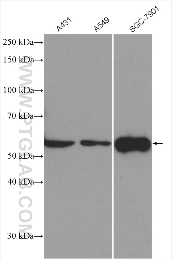 Western Blot (WB) analysis of various lysates using FBXW11 Polyclonal antibody (13149-1-AP)