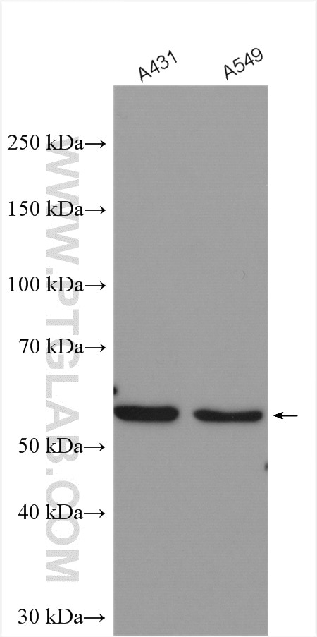 Western Blot (WB) analysis of various lysates using FBXW11 Polyclonal antibody (13149-1-AP)