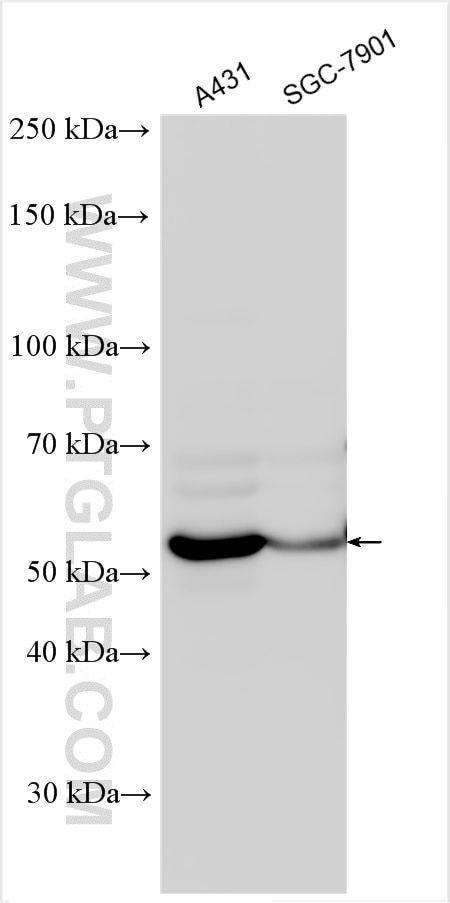 Western Blot (WB) analysis of various lysates using FBXW11 Polyclonal antibody (13149-1-AP)