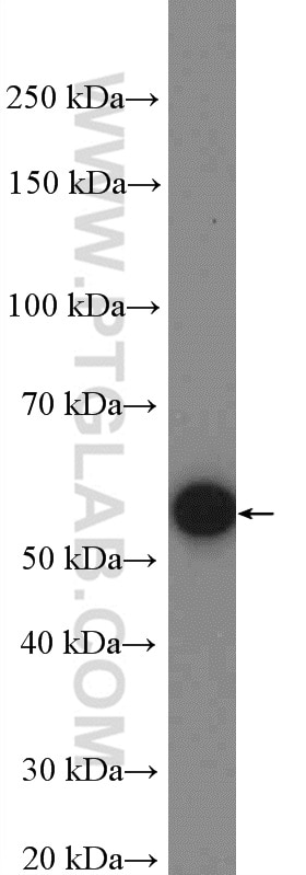 Western Blot (WB) analysis of SGC-7901 cells using FBXW11 Polyclonal antibody (13149-1-AP)