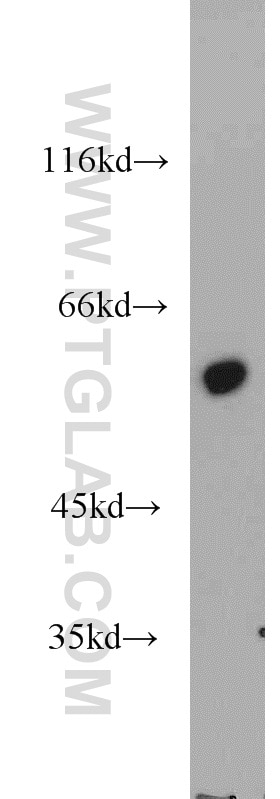 Western Blot (WB) analysis of SGC-7901 cells using FBXW11 Polyclonal antibody (13149-1-AP)