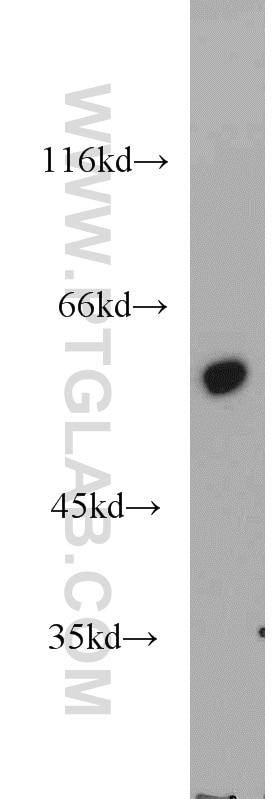 WB analysis of SGC-7901 using 13149-1-AP