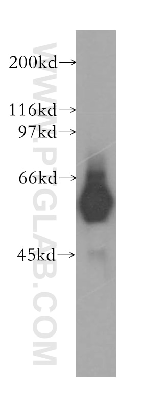 Western Blot (WB) analysis of human stomach tissue using FBXW11 Polyclonal antibody (13149-1-AP)