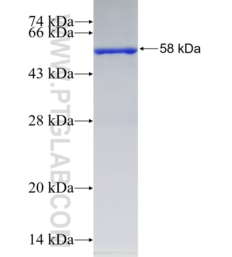FBXW11 fusion protein Ag3761 SDS-PAGE