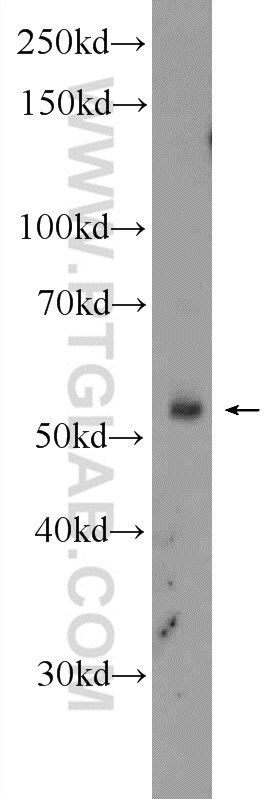 Western Blot (WB) analysis of K-562 cells using FBXW12 Polyclonal antibody (21687-1-AP)