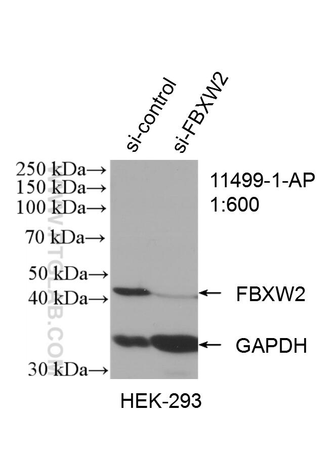 Western Blot (WB) analysis of HEK-293 cells using FBXW2 Polyclonal antibody (11499-1-AP)