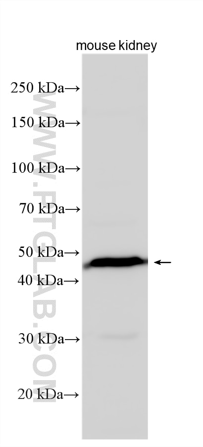 Western Blot (WB) analysis of mouse kidney tissue using FBXW2 Polyclonal antibody (11499-1-AP)