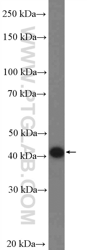 Western Blot (WB) analysis of HEK-293 cells using FBXW2 Polyclonal antibody (11499-1-AP)