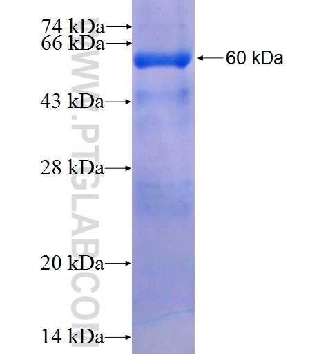 FBXW2 fusion protein Ag2045 SDS-PAGE