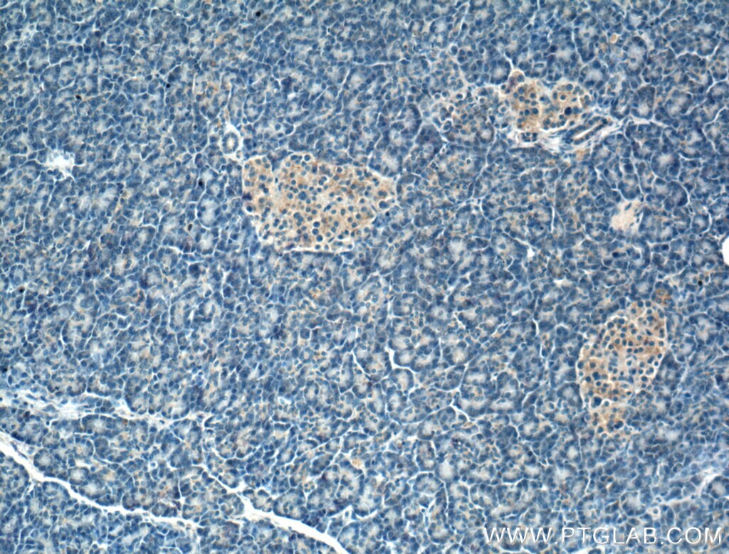 Immunohistochemistry (IHC) staining of human pancreas tissue using FBXW4 Polyclonal antibody (10657-1-AP)