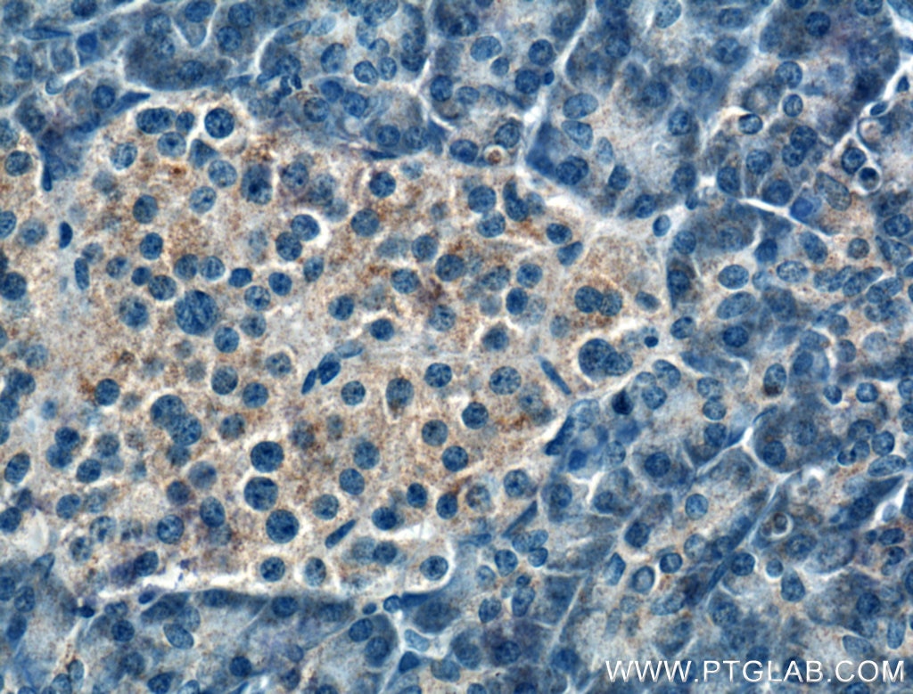 Immunohistochemistry (IHC) staining of human pancreas tissue using FBXW4 Polyclonal antibody (10657-1-AP)
