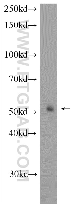 Western Blot (WB) analysis of mouse liver tissue using FBXW4 Polyclonal antibody (10657-1-AP)