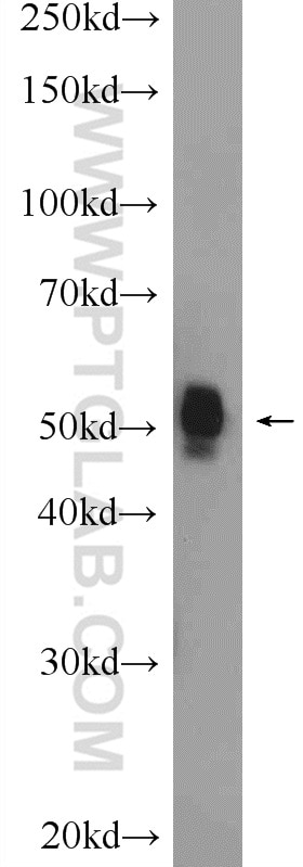 Western Blot (WB) analysis of mouse lung tissue using FBXW4 Polyclonal antibody (10657-1-AP)