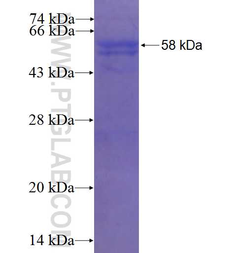 FBXW4 fusion protein Ag1047 SDS-PAGE