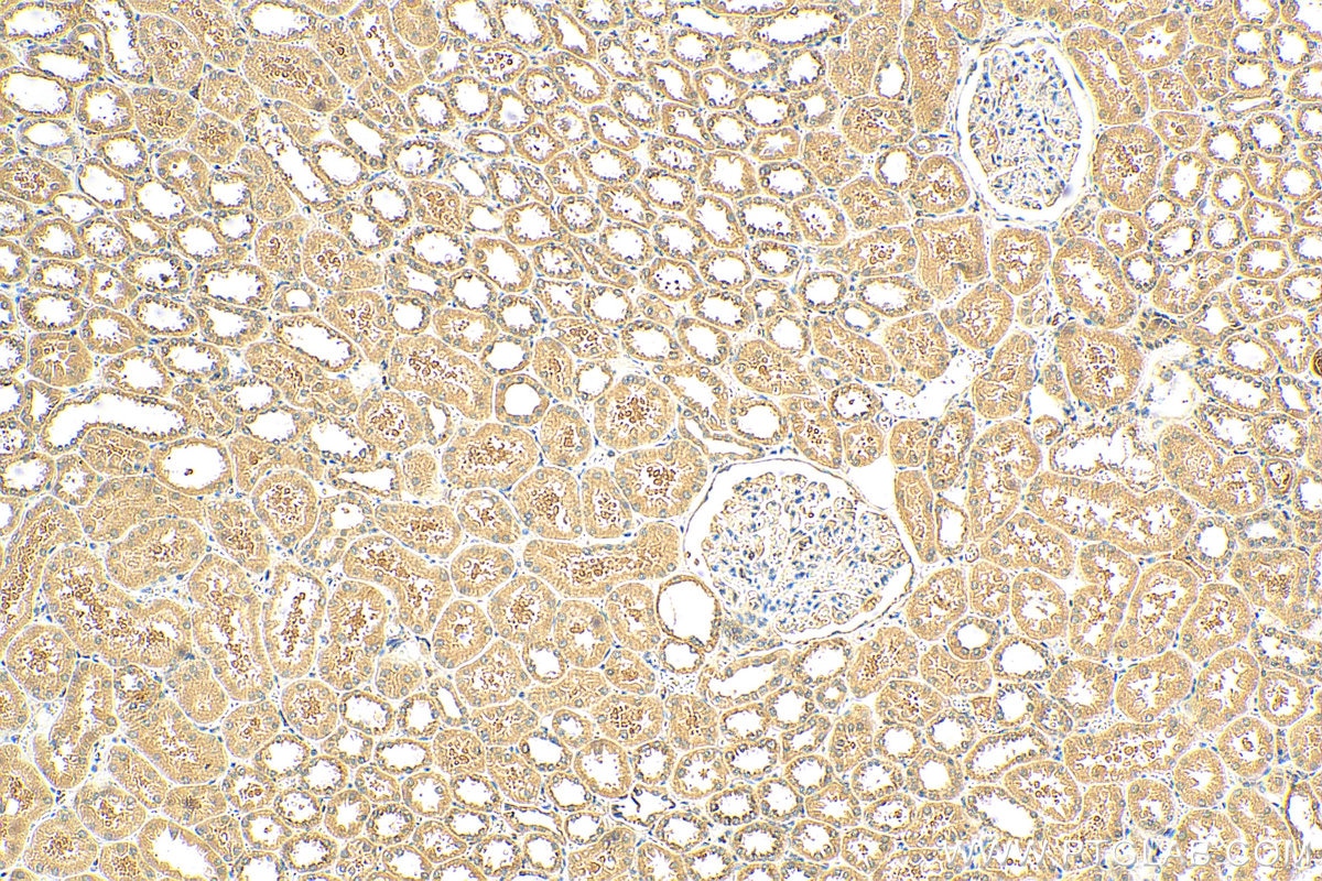 Immunohistochemistry (IHC) staining of human kidney tissue using FBXW5 Polyclonal antibody (18321-1-AP)