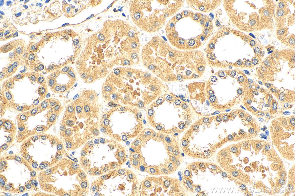 Immunohistochemistry (IHC) staining of human kidney tissue using FBXW5 Polyclonal antibody (18321-1-AP)