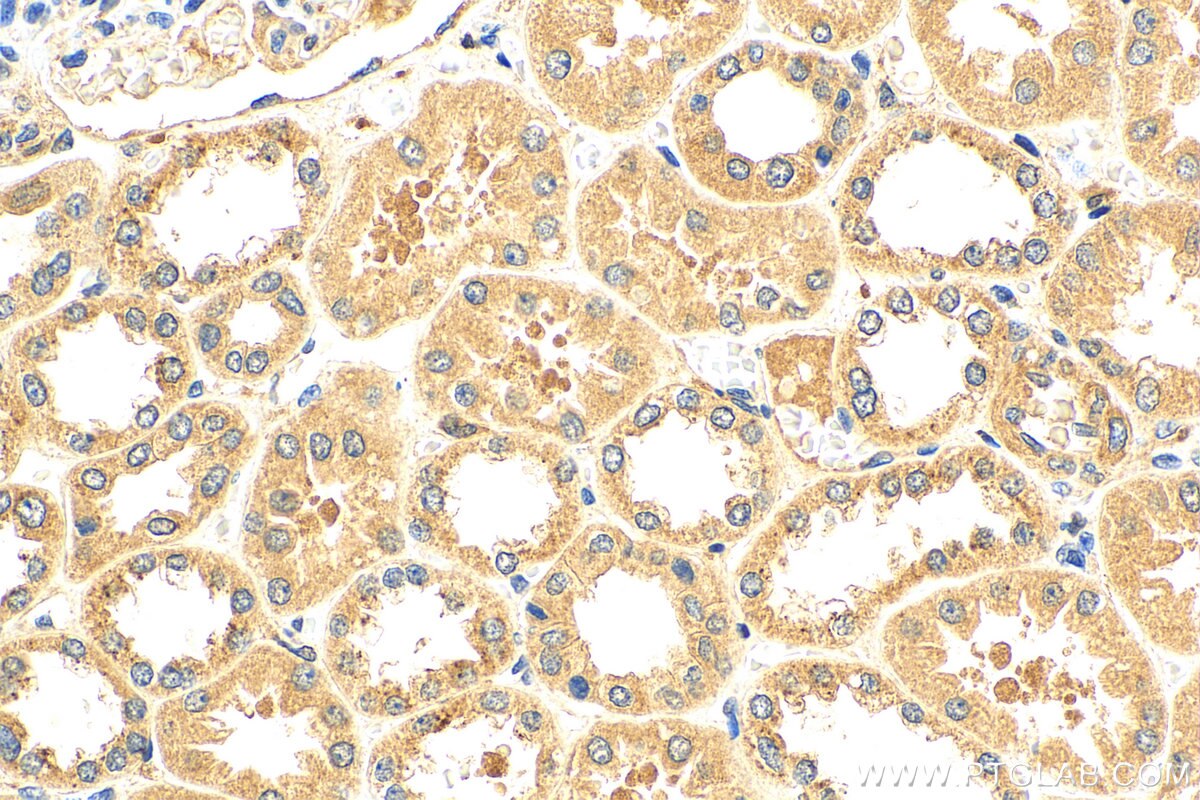 IHC staining of human kidney using 18321-1-AP