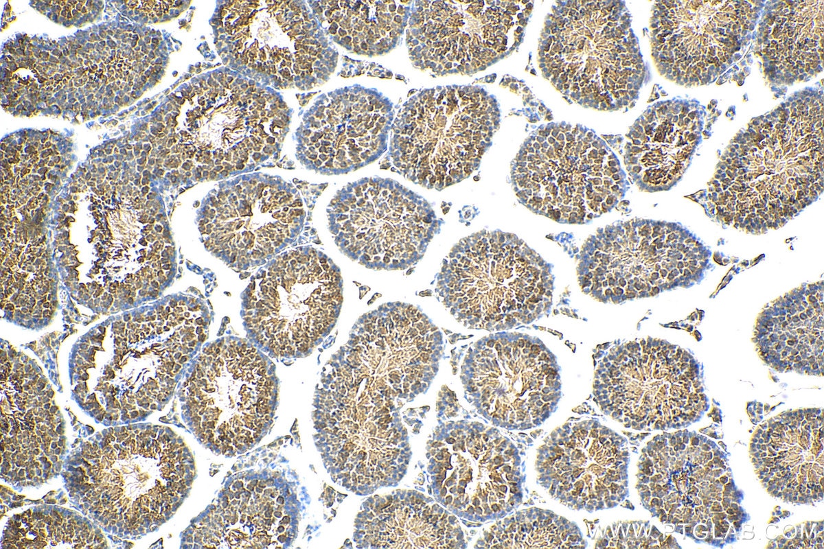 Immunohistochemistry (IHC) staining of mouse testis tissue using FBXW5 Polyclonal antibody (18321-1-AP)