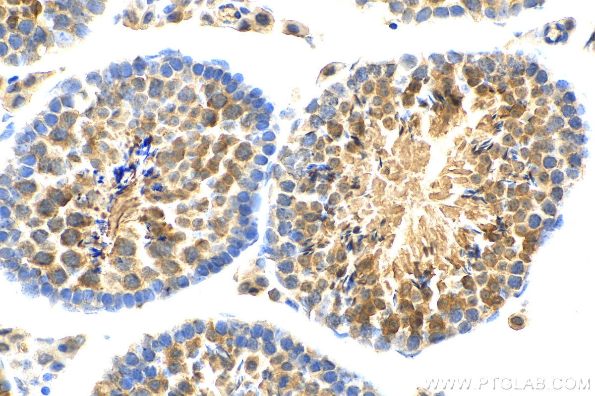 Immunohistochemistry (IHC) staining of mouse testis tissue using FBXW5 Polyclonal antibody (18321-1-AP)