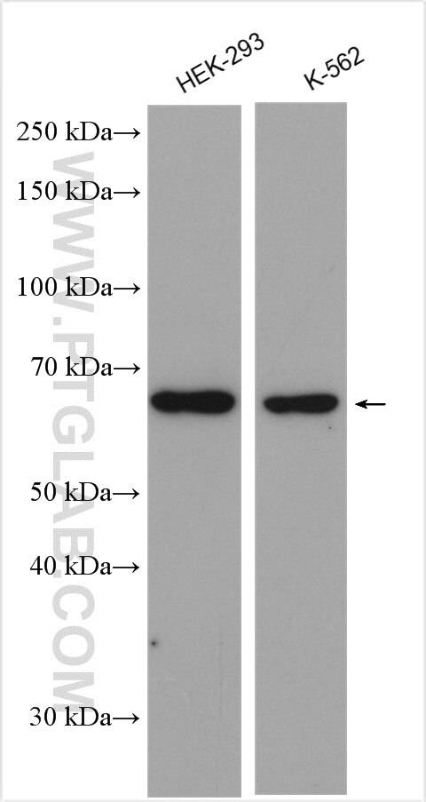 Western Blot (WB) analysis of various lysates using FBXW5 Polyclonal antibody (18321-1-AP)