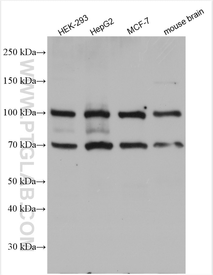 Western Blot (WB) analysis of various lysates using FBXW7 Polyclonal antibody (28424-1-AP)